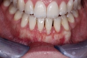 after Knoxville dentistry services