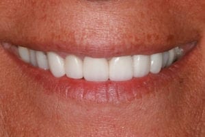 after Knoxville dentistry services