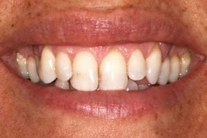 before Knoxville dentistry services