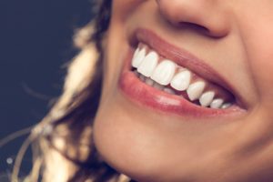 closeup image of a woman's perfect white smile professional whitening dentist in Knoxville Tennessee
